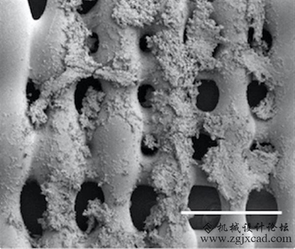 3D打印支架助科学家找到对抗骨癌新方法