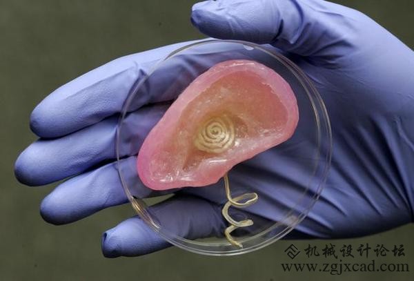 3D打印个肾！肾移植指日可待？