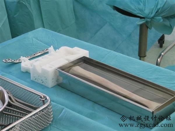 Materialise公司儿科3D打印手术导板获FDA许可
