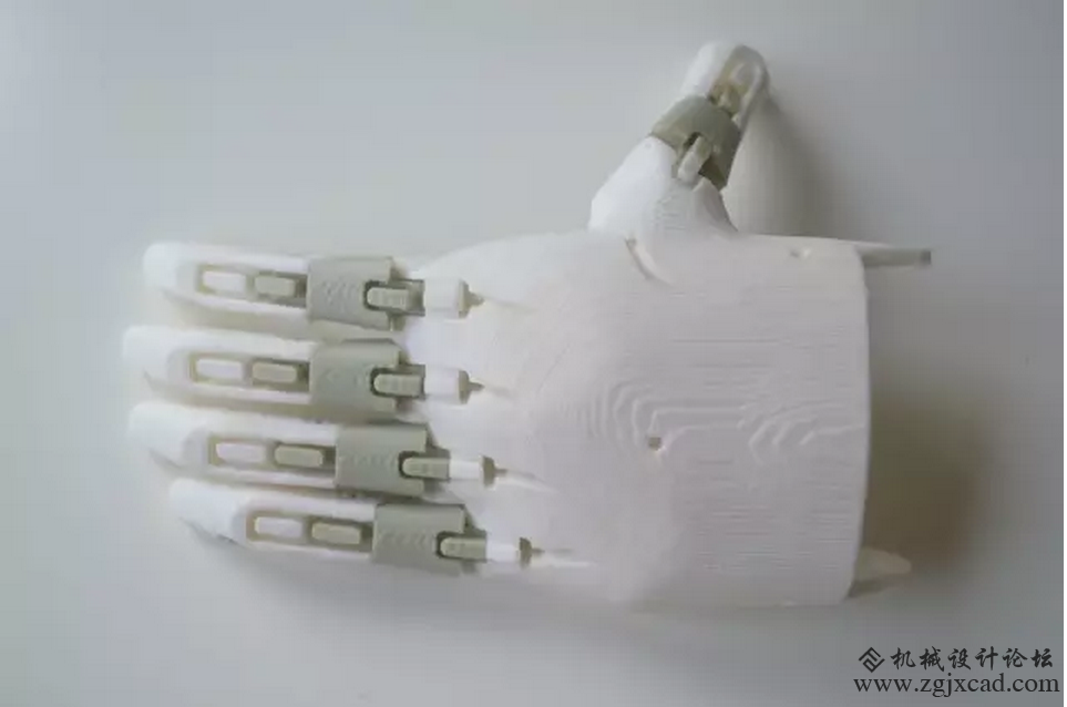 整个3D打印义肢的制作过程讲解