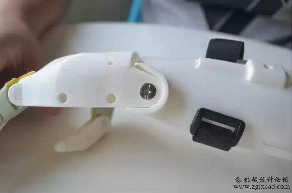 整个3D打印义肢的制作过程讲解