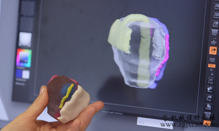 LaGuardia工作室3D打印全彩肾脏和前列腺模型用于临床试验