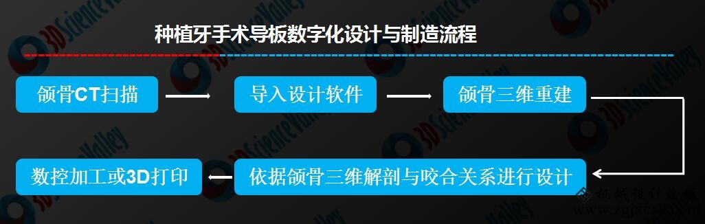 CT影像、三维设计、DLP3D打印推动下的种植牙导板数字化技术