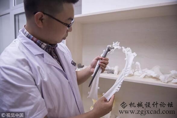 告别反人类的规格化植入体，3D打印关节了解一下